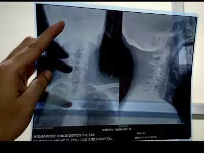 Physiotherapy in Kolkata Radio